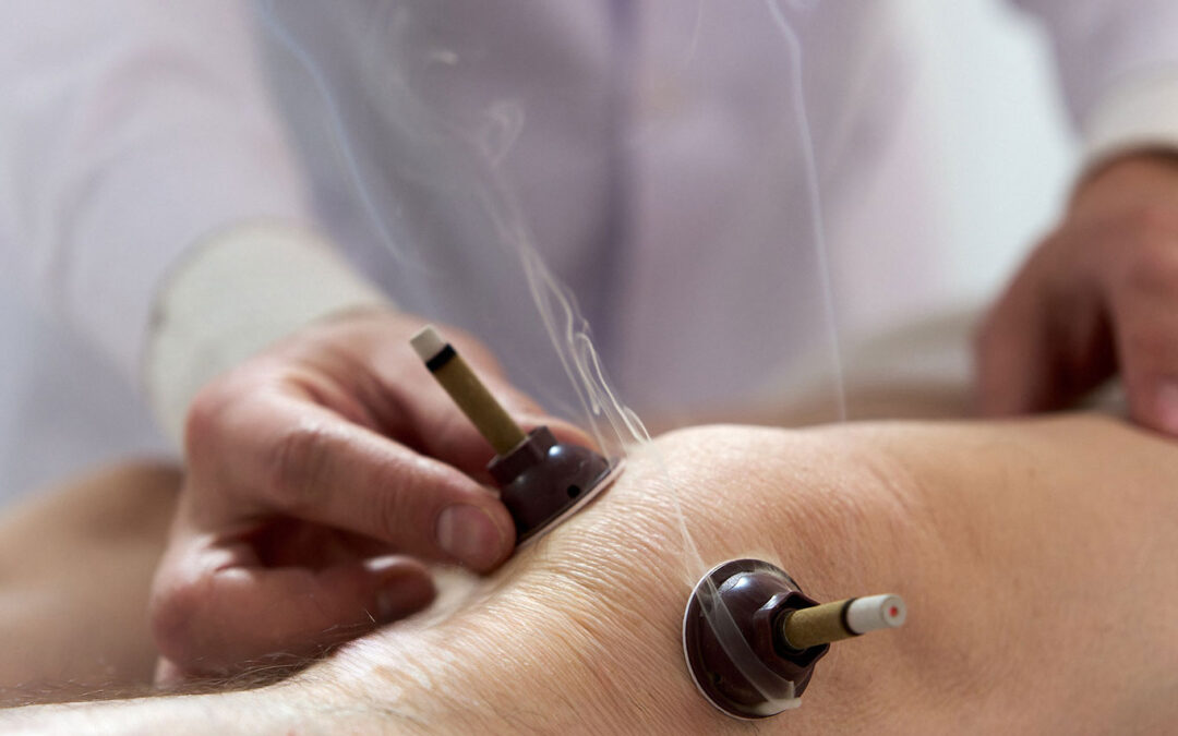Tratamiento del dolor de rodilla con acupuntura y medicina china